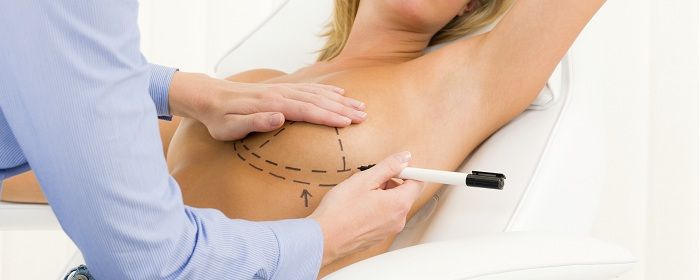 Implantul mamar: procedura, recuperare, complicatii, alaptare