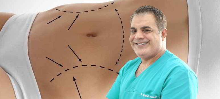 abdominoplastie-dupa-cezariana.jpg