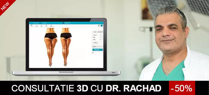 Consultatie 3d liposuctie